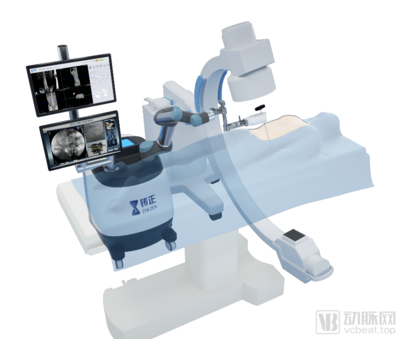 核心技术持续加码,铸正机器人引领中国脊柱微创手术机器人转型