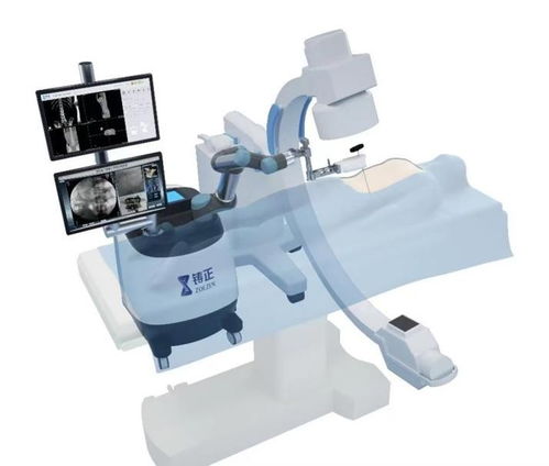 脊柱手术可选铸正骨科手术机器人,提高手术精准率